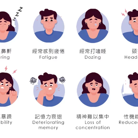 The symptoms of OSA are snoring, fatigue, dozing, headache, irritability, deteriorating memory, loss of concentration & reduced libido