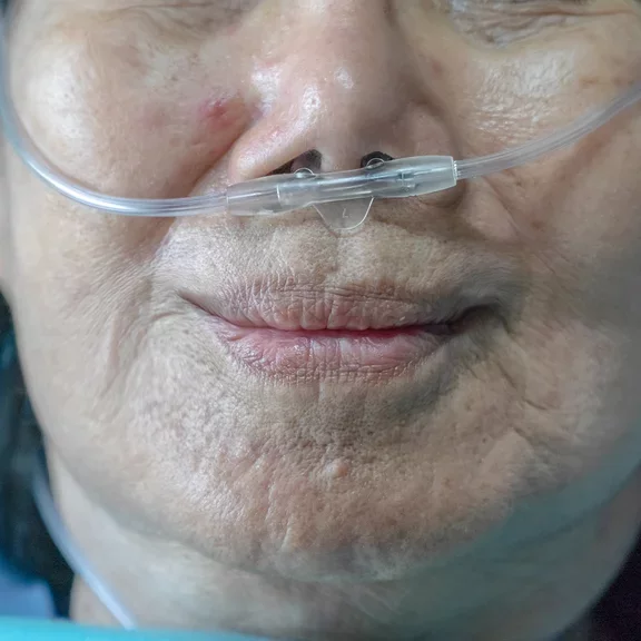 A lady undertaking oxygen therapy with a nasal breathing tube